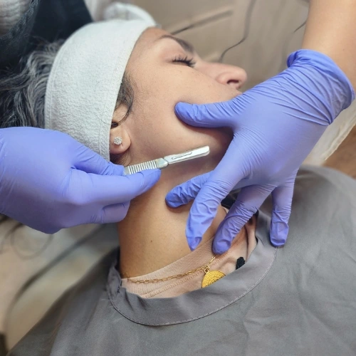 Dermaplaning at Glow Facial Bar: purple-gloved hands guide a blade along a client's jaw